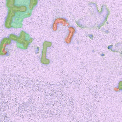 AI prediction for tile 0069 — bracket and L-shaped platforms closely matching expert labels